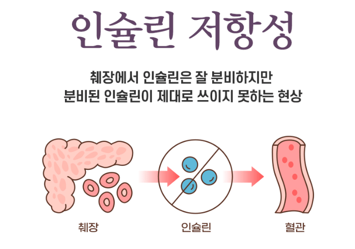 당뇨와 인슐린 저항성 중요성